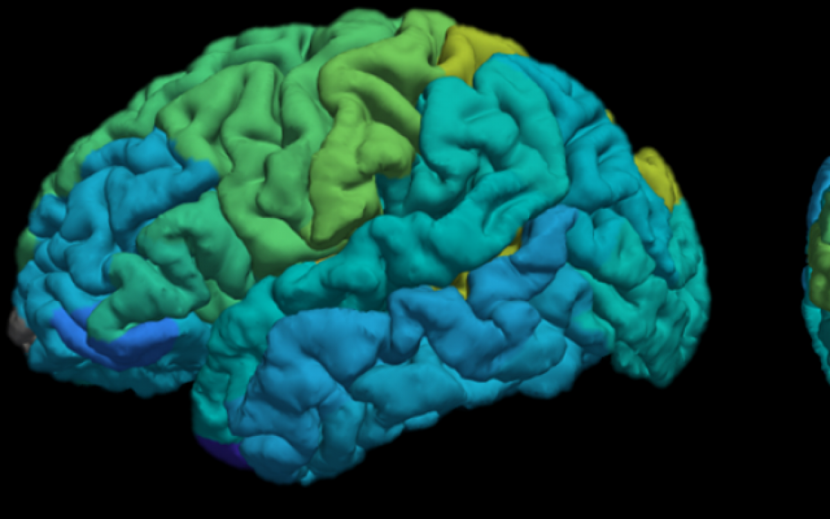 Новый аппарат МРТ Еврейского университета способен выявлять молекулярные изменения в мозгу