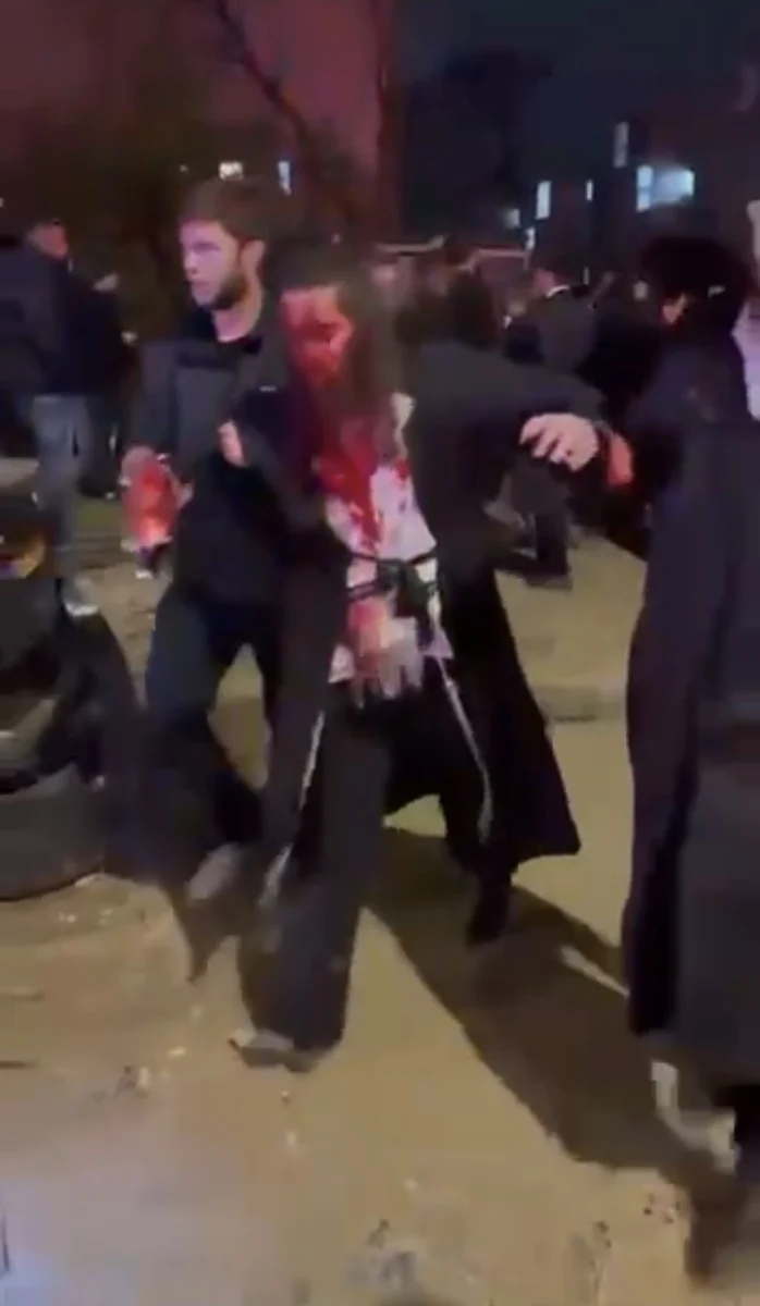 Прямое попадание в центре города Арад 3 Прямое попадание в центре города Арад 3